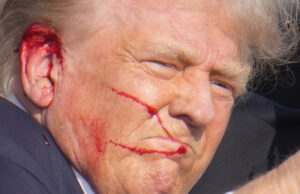 Снимка на Тръмп след нападението Снимка: АП