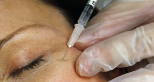 АФП: Устни, зъби и гърди: Албания печели от медицински туризъм