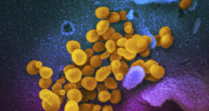 Меркел отхвърли твърденията, че Германия е прикривала информация за произхода на ковид