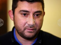 Не може произволно да се правят промени в реда и условията за паркиране, без да се знае финансовият ефект, заяви Корлос Контрера от ВМРО